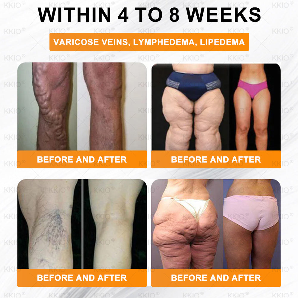 🎁𝐾𝐾𝐼𝑂®  has a surprise upgrade just for you! You've already got an amazing offer but now you've unlocked an even better one:You'll get a massive 50% off your next purchase - for the next two minutes only!